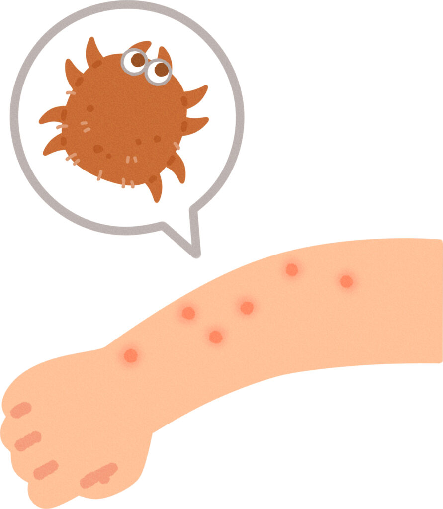 ダニに毎日刺されてかゆい様子のイラスト
