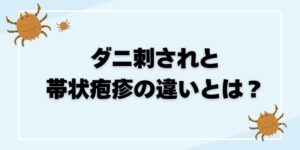 ダニ刺されと帯状疱疹の違いとは？